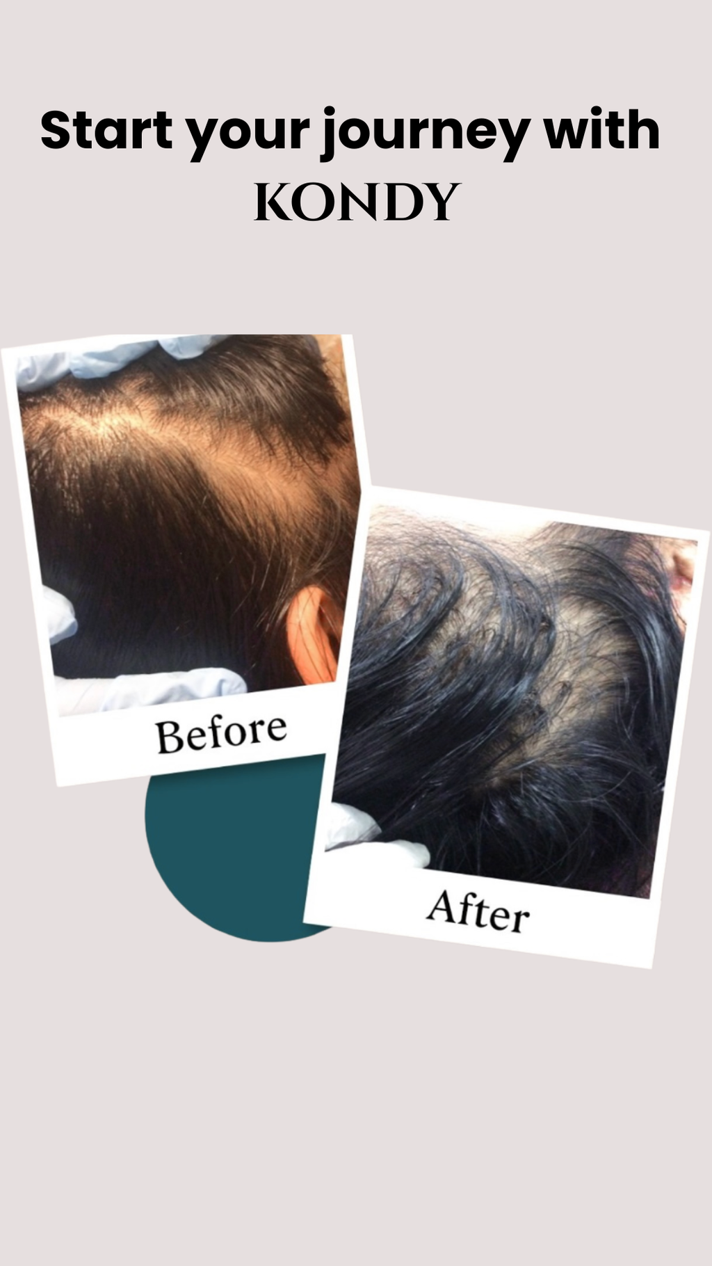 KONDY ADVANCE DENSITY SERUM