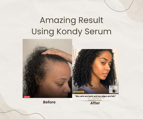 KONDY ADVANCE DENSITY SERUM