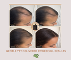 KONDY ADVANCE DENSITY SERUM