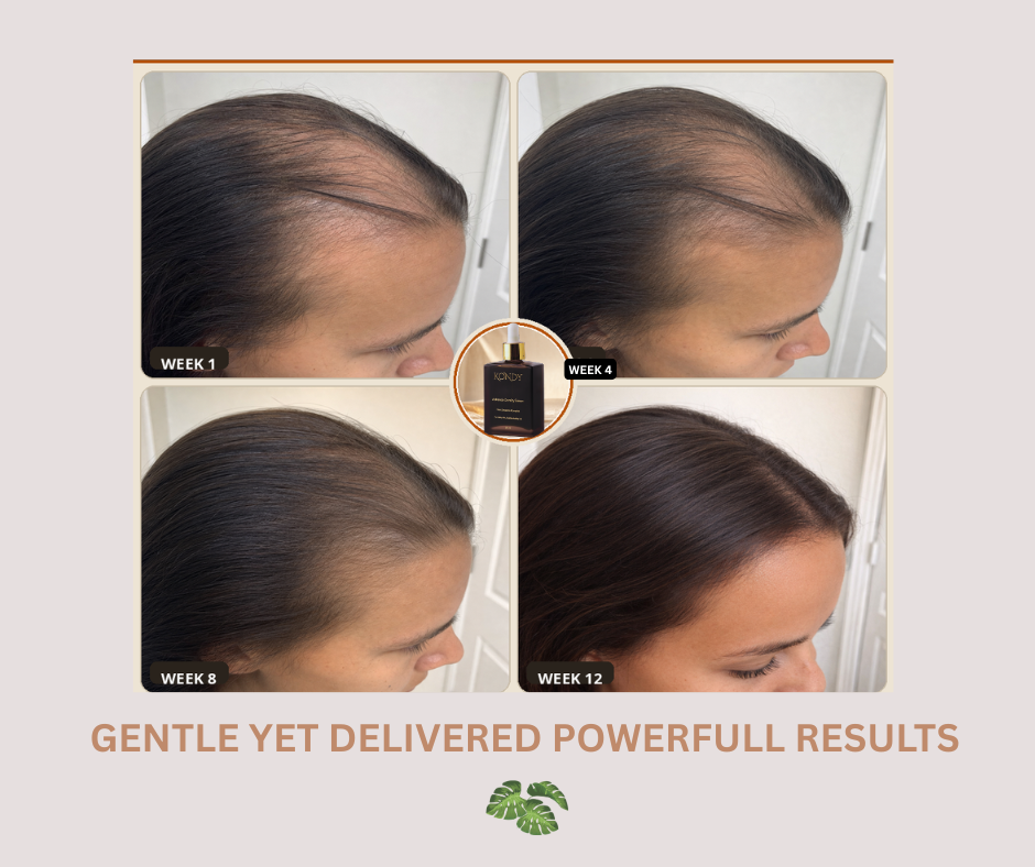 KONDY ADVANCE DENSITY SERUM