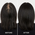 KONDY ADVANCE DENSITY SERUM