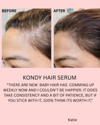 KONDY ADVANCE DENSITY SERUM