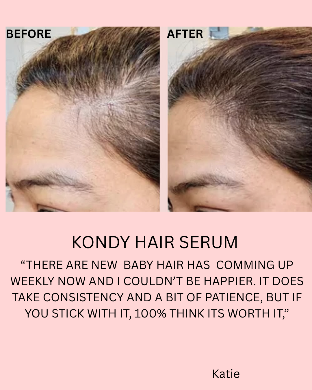 KONDY ADVANCE DENSITY SERUM